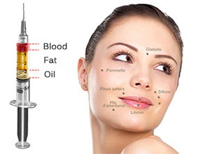 Face-lipofilling-areas-Tunisia